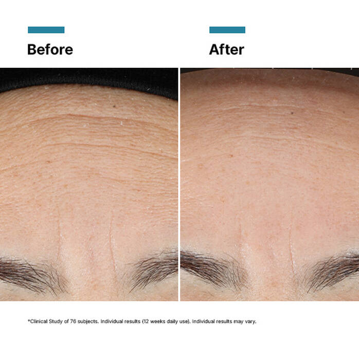 SkinCeuticals Advanced RGN-6