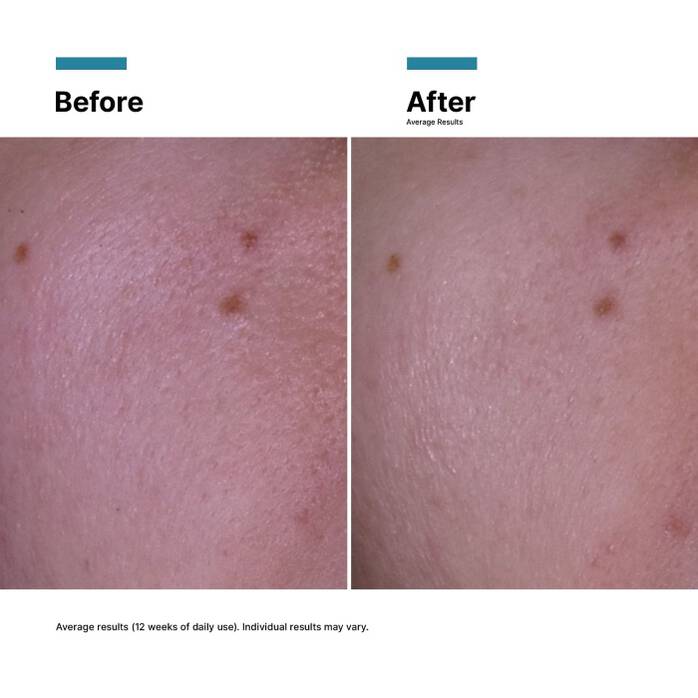 SkinCeuticals P-TIOX Cream