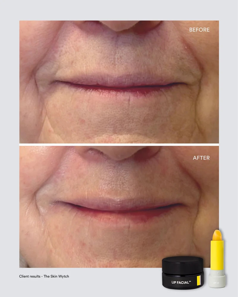 Albus & Flora Lip Facial