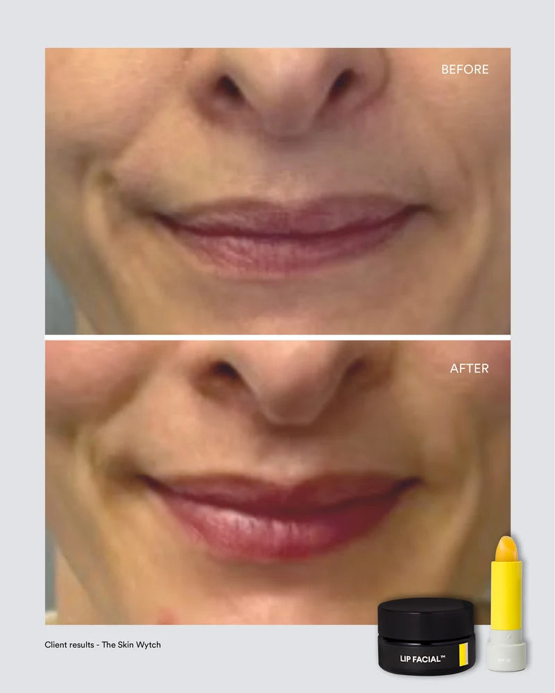 Albus & Flora Lip Facial